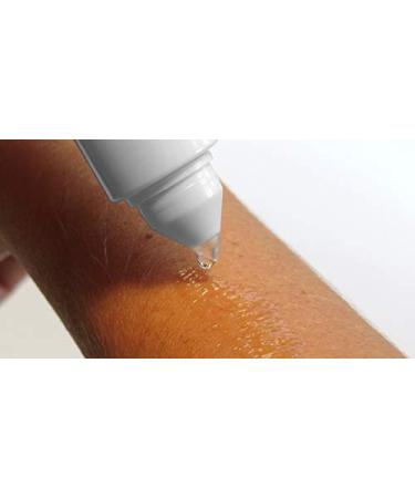 Saalux Dandruff Remover Refill Bottle 200ml | Soft-Tip Applicator Refill | International Shipping Available - Buy Online on GoSupps.com