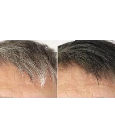 antiaging antioxidant Supplement - Anti Gray Hair - GRAVIOLA Complex - Nettle Root Powder - Combo - 2 Bottles - Buy Online on GoSupps.com