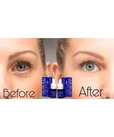 ORIGINAL Collyre Bleu Blue Laiter Eye Drop - 10ml - New Packaging Same Formula! - Buy Online on GoSupps.com