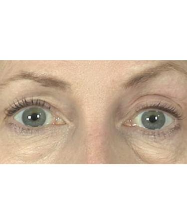 Butterfly Invisible Double Eye Lift - Instant Eye Lift Adhesive Strips - Buy Online on GoSupps.com