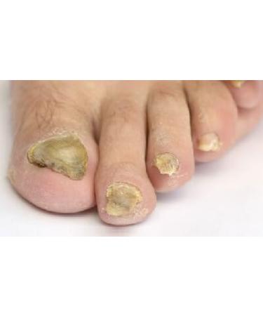 100% Pure American Made Emu Oil 4oz | All Natural Fully Refined for Multiple Uses - Buy Online on GoSupps.com