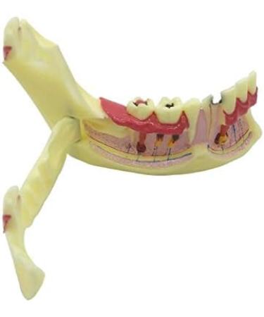 Ernzi Lower Jaw Decomposition Model - Realistic Dental Simulation & Teaching Tool for Oral Health Education - Buy Online on GoSupps.com