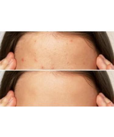 Bionature Huile de Cade 100% naturel Bio 50ml - Buy Online on GoSupps.com