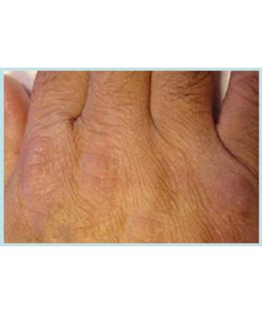 Buy Hylunia Hyaluronic Reconstructive Creme with Pomegranate - 5.1 fl oz | International Shipping Available - Buy Online on GoSupps.com