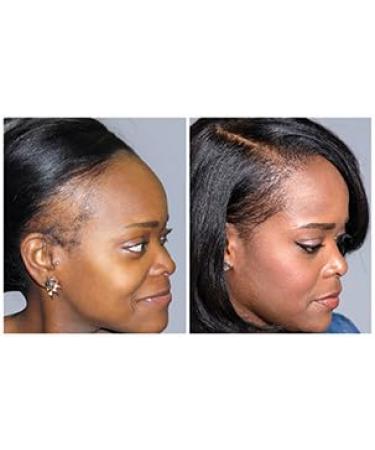 Gold Banner Beauty LOC D 4 LYFE Edge Resuscitator 4oz - Hair Loss Treatment for Locs Braids & Wigs | Strengthen & Nourish Edges - Buy Online on GoSupps.com