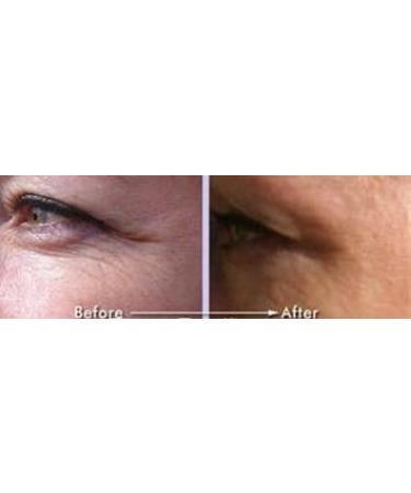 Golden Serum for Skin Tightening | Firming & Sagging Prevention | 20% Argireline DMAE Marine Algae Vitamin C | Paraben Free 50ml - Buy Online on GoSupps.com