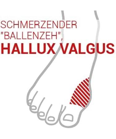 EPITACT Hallux Valgus Correction Bandage Sport Size L | Relief for Sneaker Comfort | International Shipping Available - Buy Online on GoSupps.com