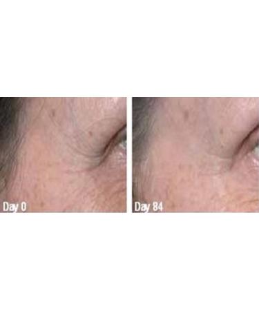 Golden Serum for Skin Tightening & Firming - 20% Argireline DMAE Hyaluronic Acid Vitamin A & C - Paraben Free 1 oz - Buy Online on GoSupps.com