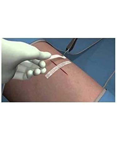 3M Healthcare Steri-Strip 1/4 x 4 Reinforced - Specialty Dressings Woundcare - 10 Strips - Buy Online on GoSupps.com