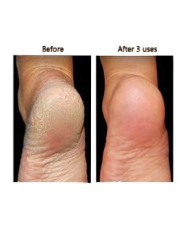 Key Lime Salt Scrub - Secrets of the Islands 16 oz | Exfoliating Body Scrub for Glowing Skin - International Shipping Available - Buy Online on GoSupps.com