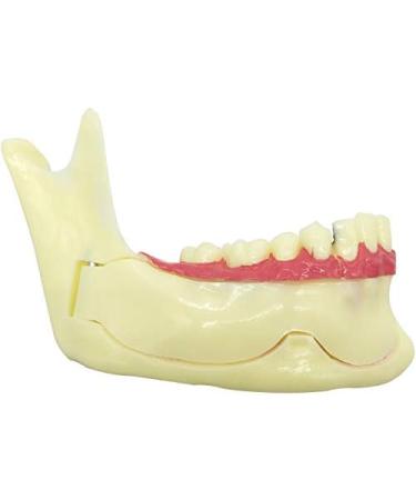 Ernzi Lower Jaw Decomposition Model - Realistic Dental Simulation & Teaching Tool for Oral Health Education - Buy Online on GoSupps.com