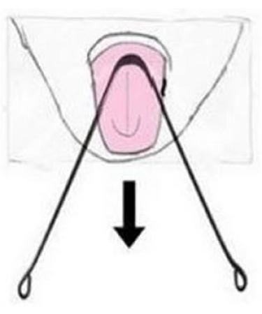 Premium Copper Tongue Cleaner - Enhance Oral Hygiene for Fresh Breath | International Shipping - Buy Online on GoSupps.com