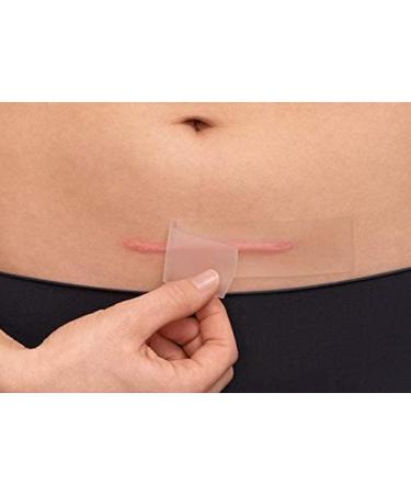 Hansaplast Scar Reduction Plasters - 21 XL Pieces (3 cm x 14.6 cm) for Visible Scar Healing | Soft & Flat Scars - Buy Online on GoSupps.com