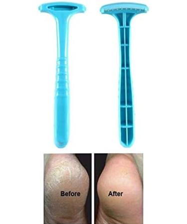 ZXB-Shop Footrest Footfish W scher - Ultimate Pedicure Tool for Removing Dead Skin & Cracked Heels - Buy Online on GoSupps.com