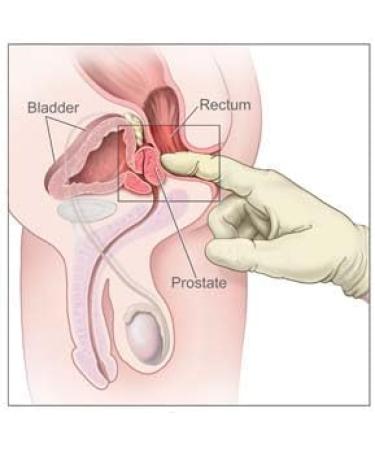 Pulean Formula - Natural Enlarged Prostate Support Winner of 5 Awards. 240 Tablets - Buy Online on GoSupps.com