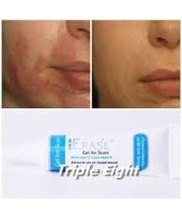 Erase Gel for Scar - 15g Keloid, Acne & Surgery Scars Remover + Free Beauty Gift - Buy Online on GoSupps.com