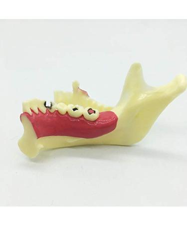 Ernzi lower jaw decomposition model - teeth lessons model - dental demonstration decomposition - simulation oral dental teeth demonstration model
