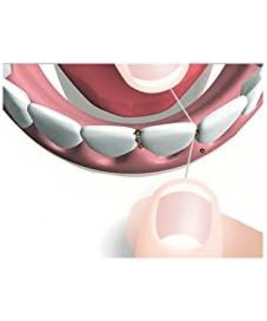 Mirafloss Unwaxed Dental Floss - Pack of 3 (60m) | Premium Quality for Optimal Oral Care | International Shipping Available - Buy Online on GoSupps.com