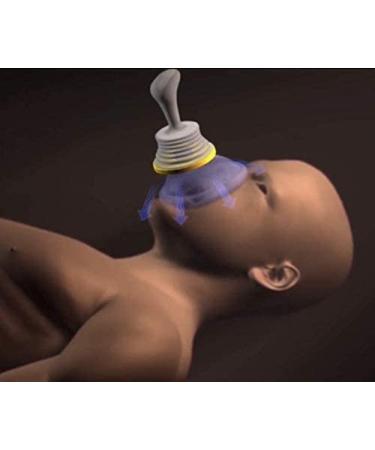 LifeVac Choking Rescue Device Home Kit for Adults and Children - Portable First Aid Choking Device (Pack of 2) - Buy Online on GoSupps.com