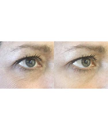 Rapid Reduction Eye Cream - Tightens Skin & Smooths Wrinkles for a Flawless Look | Shop Internationally - Buy Online on GoSupps.com