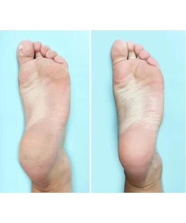 Ever Ready Dual Action Cellular Glass Pumice Stone for Feet Callus Remover/Foot Scrubber 4 x Pack - Buy Online on GoSupps.com