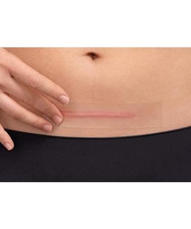 Hansaplast Scar Reduction Plasters - 21 XL Pieces (3 cm x 14.6 cm) for Visible Scar Healing | Soft & Flat Scars - Buy Online on GoSupps.com