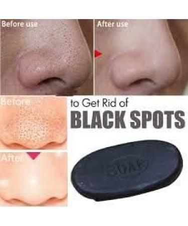 Activated Charcoal Soap: Face and Body Bar for Natural Treatment of Acne Psoriasis Body Odor and Excessive Oil - Organic Vegan Skin Care - Buy Online on GoSupps.com