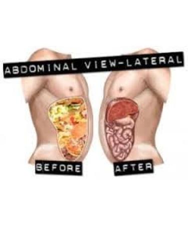 Miracle Oxy-Colon Cleanse Vegan Colon Cleanser - 3 Bottles - 120 Vegetarian Capsules. - Buy Online on GoSupps.com