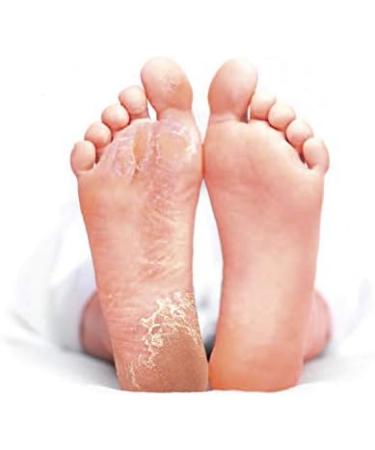 Balea Callus Remover Socks - Effective Callus Removal | 1 Pair (2 Pieces) for Soft Smooth Feet - Buy Online on GoSupps.com