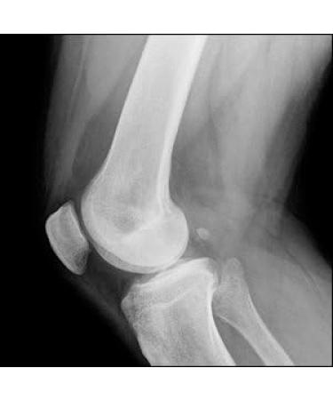 Lindberg Joint Support Supplement for Men and Women | 210 Capsules | with Turmeric MSM Glucosamine Chondroitin Boswellia Extract | Triple Action Complex Blend | Non-GMO Gluten Free - Buy Online on GoSupps.com