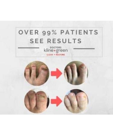 Drs. Kline + Green Clear + Restore Nail Treatment 3 Month Supply - 0.90 oz - Buy Online on GoSupps.com