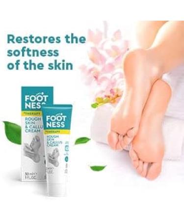 FOOTNESS Callus Cream with 2% Salicylic Acid - Smooth & Soften Rough Skin in 7 Days (30ml) - Buy Online on GoSupps.com