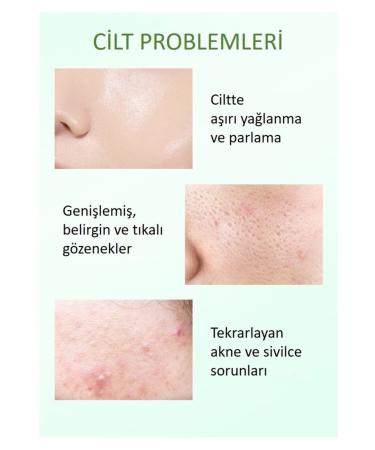 BIOAQUA Salicylic Acid Anti-Acne Care Oil Control Mask 120 gr - Buy Online on GoSupps.com