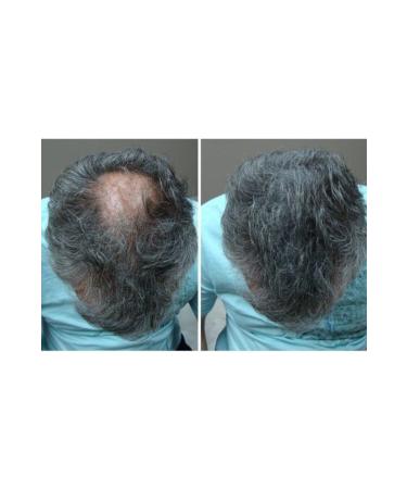 FIXPLANT 28 gr Hair Hair Fiber - Thickener - Hair Powder - Black - Buy Online on GoSupps.com