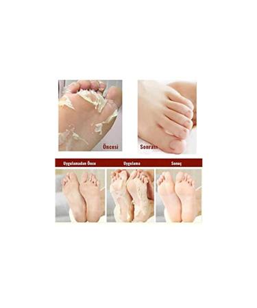 Miracle Foot Peeling Pack - Sock Type Foot Peeling Mask - Buy Online on GoSupps.com
