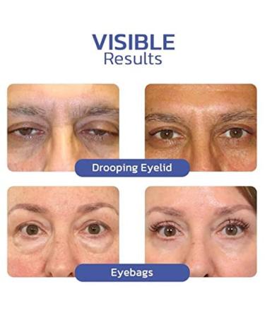 Bigeyes Lifting Eyelid Contouring Cream - Eyelid Defining Beauty Gel for Droopy Eyelids & Wrinkles (2pcs) - Buy Online on GoSupps.com
