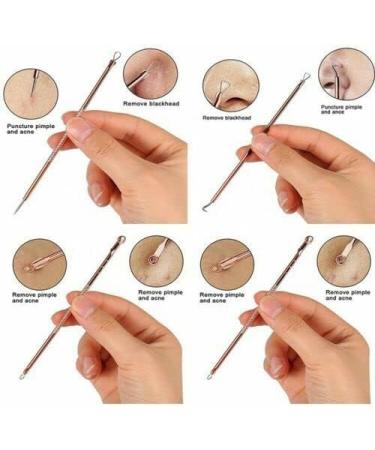 Blackhead Remover Tool Pimple Popper Tool Kit Stainless Steel Acne Needles Easy Removal of Pimples Acne Whitehead Blemish Zit Removing Forehead Facial and Nose (Rose Gold) - Buy Online on GoSupps.com