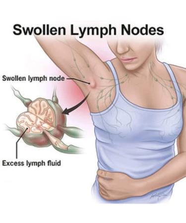 Lymph Node Detox Cream & Ointment Set - Lymphatic Drainage Relief | Pain Relief for Neck & Armpit - 3 Pieces - Buy Online on GoSupps.com