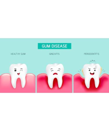 Perio Restore Gel 3oz Tube - 1.7% Hydrogen Peroxide Oral Cleansing Treatment - Buy Online on GoSupps.com