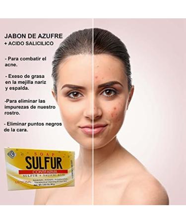 Contifarm AZUFRE + cido Salic lico Jab n - Tratamiento Efectivo para el Acn con Jab n de Azufre y cido Salic lico - Env o Internacional Disponibles - Buy Online on GoSupps.com