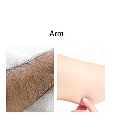 Pain-Free Women s Hair Removal Cream for Sensitive Skin Intimate Legs and Armpits | Gentle Depilation Solution - Buy Online on GoSupps.com