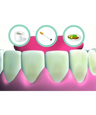 Miradent Mirawhite Shine Bleaching Gel 1.8 ml - Gentle Peroxide-Free Whitening for Bright White Teeth | Hygienic Formula with Active Oxygen - Buy Online on GoSupps.com