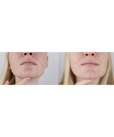 Su-Skin Face Moisturizer - Rejuva Gel for Dry Skin with Vitamin E & Glycerin - Hydrating Dermal Repair - Buy Online on GoSupps.com