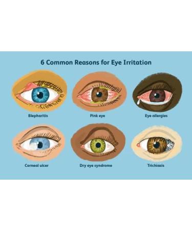 Hhkuize TLOPA Ultra Eye Therapy Drops - Buy 1, 2, or 3 Boxes | Tlopa Ultra Eye Drops - 20pcs per Box - Buy Online on GoSupps.com