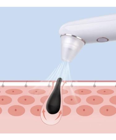 JYYBN Blackhead Remover 3 Adjustable Suction Power Facial Pore Cleaner Electric Acne Comedone Whitehead Extractor Tool with 3 Probes - Buy Online on GoSupps.com