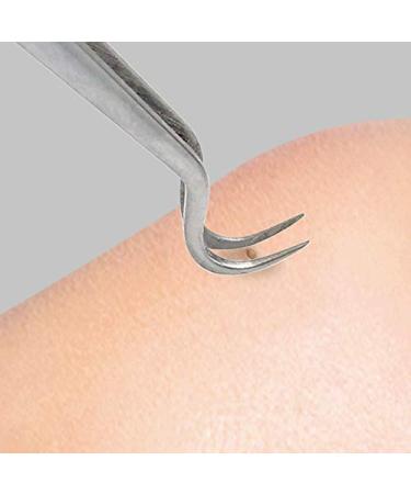 Lindo Black Out Blackhead Tweezer - Effective Blackhead Removal Tool - Buy Online on GoSupps.com