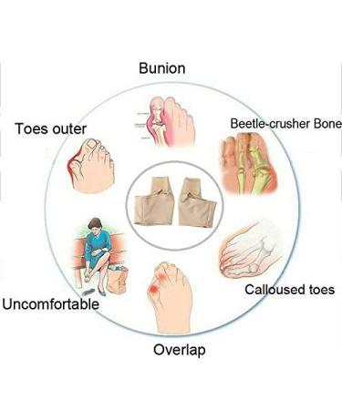 Buy Bunion Corrector - Pain Relief Hallux Valgus Bunion Socks & Orthopedic Gel Splint for Men & Women | Shop Internationally - Buy Online on GoSupps.com
