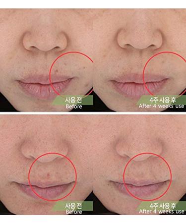 Dasoni Centella Cream 1.69oz - Skin Renewal & Sensitive Relief - Buy Online on GoSupps.com