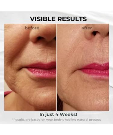 BIONOVA Anti-Aging Upper Lip Treatment with UV Chromophores - Reduce Mild to Deep Vertical Lip Lines Wrinkles and Prevent Lipstick Bleeding (0.5 oz) - Buy Online on GoSupps.com