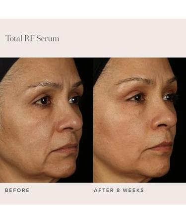 Rodan + Fields Total RF Serum 30 mL | Hydrating Anti-Aging Skincare for Women | Deep Wrinkle & Fine Line Treatment | Morning & Night Self-Care Routine - Buy Online on GoSupps.com